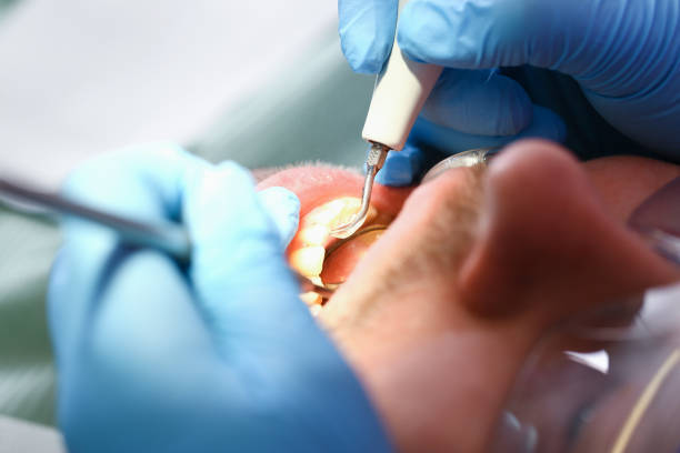Best Emergency Pediatric Dental Care in Easton, MD