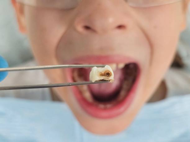 Best Emergency Denture Repair in Easton, MD